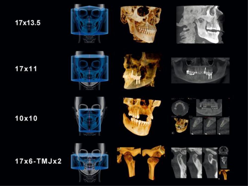 顎関節部3D画像
